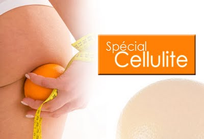 La cellulite