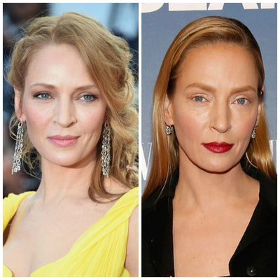 Oh oh What has Uma Thurman done to her face ?